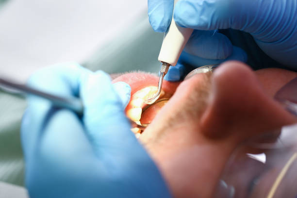 Best Emergency Dentist for Knocked-Out Tooth in Waverly, IA