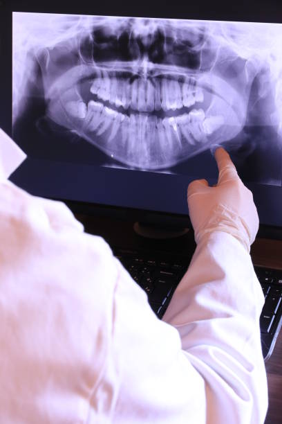 Best Emergency Dental Services for Seniors in Waverly, IA